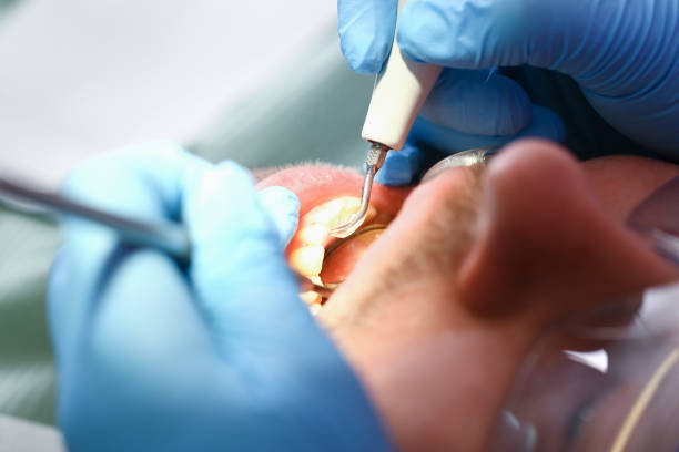 Best Emergency Treatment for Toothache in Independence, LA